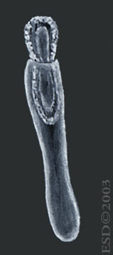 Hydrozoa