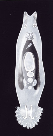 Trematoda