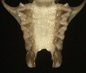 lavia_palatal_th