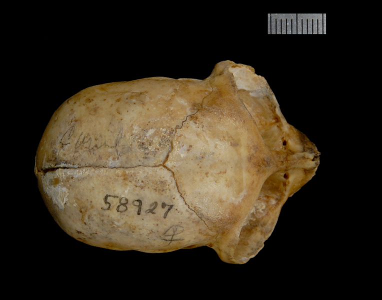 dorsal2537