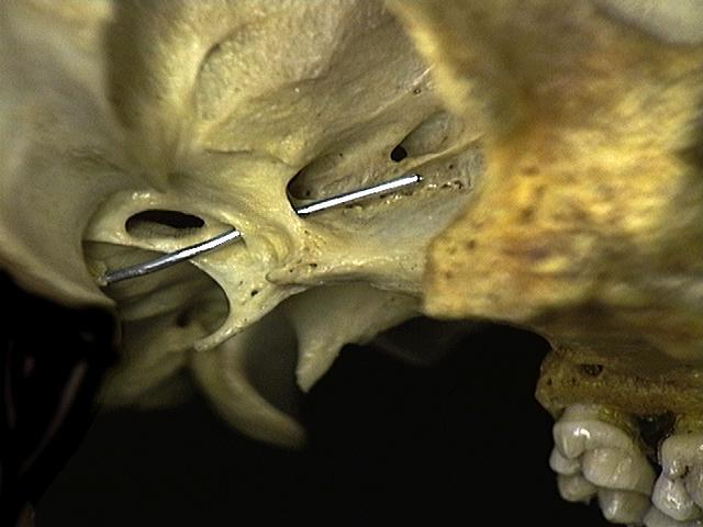 Craniata