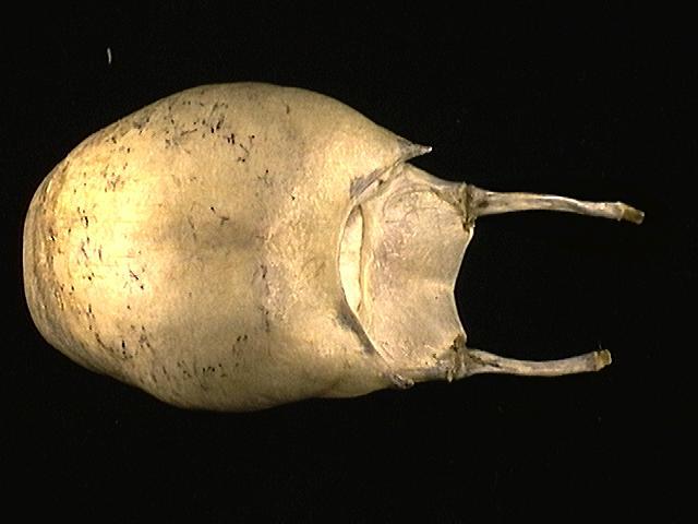 Gnathostomata