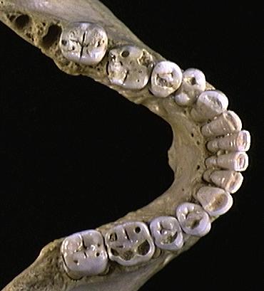 Gnathostomata