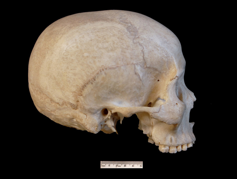 Craniata