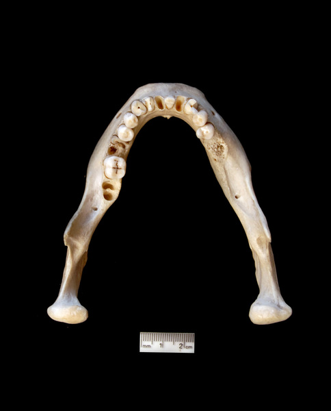 lower_dorsal