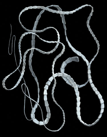 Taenia_saginata