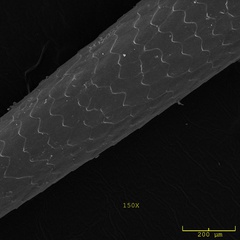 Figure 5. Ponta ampliada da coluna vertebral comum sem tailless tenrec.