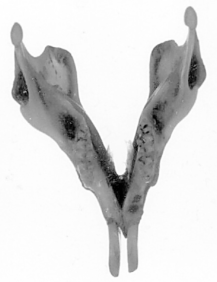 Eumetazoa